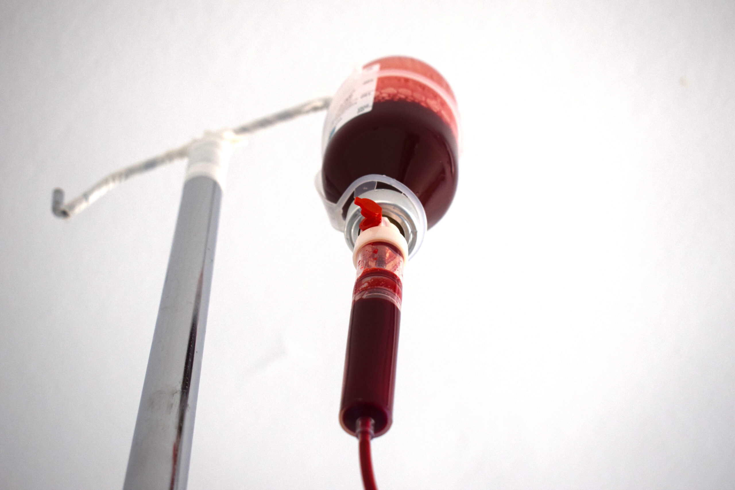 Ozone Therapy Image